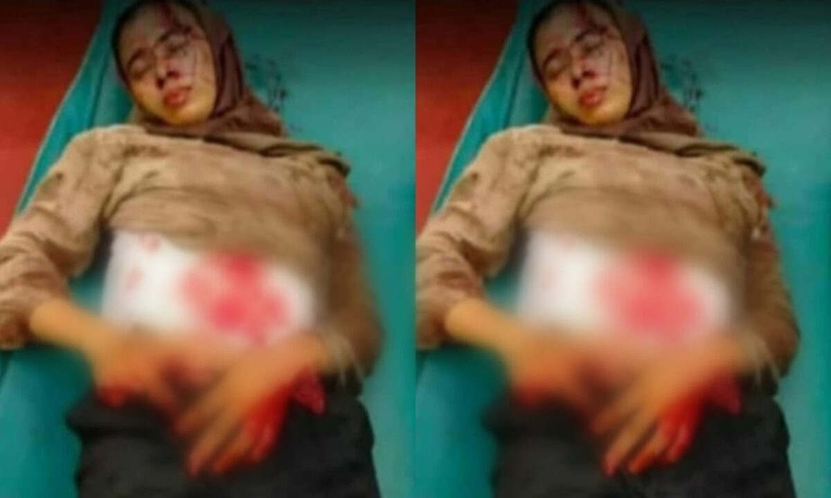 Kolase foto wanita terluka disebut karyawan bank mekar, Padang Cermin, Pesawaran. Foto : Viral/Media Prioritastv.com.