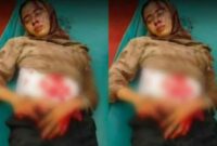 Kolase foto wanita terluka disebut karyawan bank mekar, Padang Cermin, Pesawaran. Foto : Viral/Media Prioritastv.com.