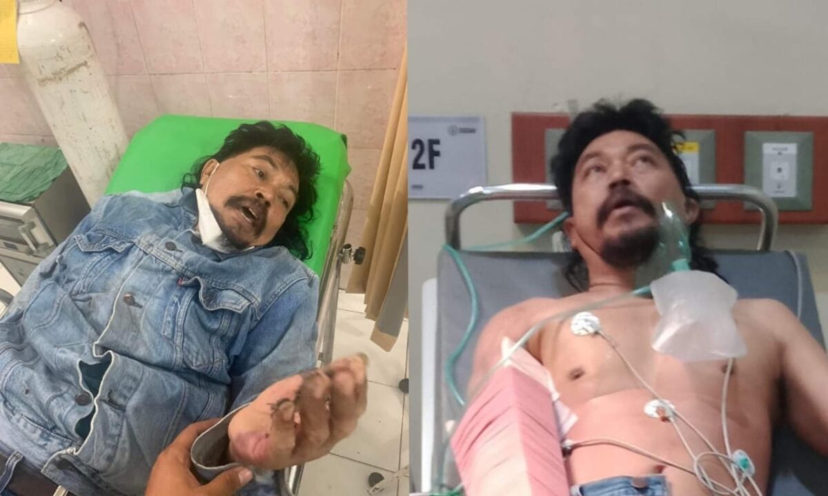 Kolase foto saat korban baru sampai di rumah sakit dan setelah penanganan di RSUD Abdoel Moeloek Bandar Lampung, Kamis 15 Februari 2024. Foto : Facebook Khamid.