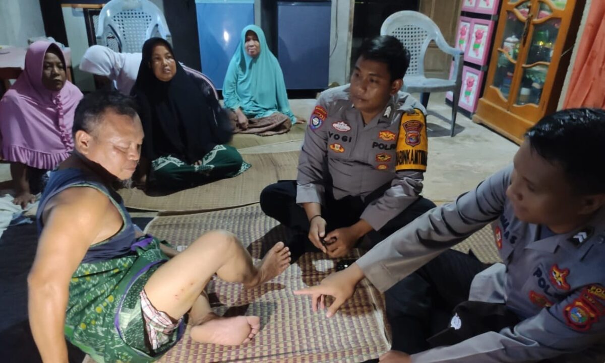 Bambang menunjukan pahanya kepada polisi yang datang ke rumahnya usai digigit buaya di sungai Way Rilau, Cukuh Balak, Tanggamus, Rabu 6 Maret 2024. Foto : Syamsul Kheir/Media Prioritastv.com.