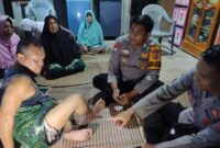 Bambang menunjukan pahanya kepada polisi yang datang ke rumahnya usai digigit buaya di sungai Way Rilau, Cukuh Balak, Tanggamus, Rabu 6 Maret 2024. Foto : Syamsul Kheir/Media Prioritastv.com.