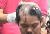 Kondisi kepala korban Samanan saat penanganan medis di RSUD Alimuddin Umar, Senin 11 Maret 2024, malam. Foto : Kamto Winendra/Media Prioritastv.com.