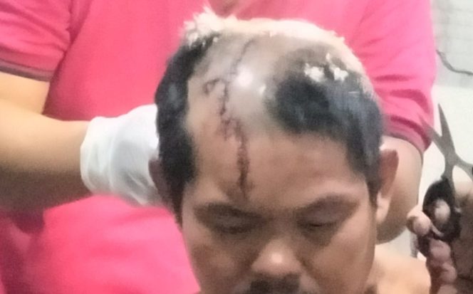 
 Kondisi kepala korban Samanan saat penanganan medis di RSUD Alimuddin Umar, Senin 11 Maret 2024, malam. Foto : Kamto Winendra/Media Prioritastv.com.