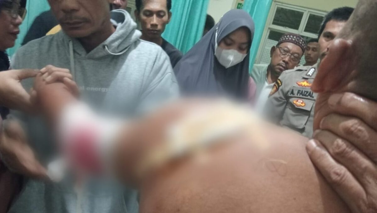 Korban Hermawan saat Ditangani Pihak Medis akibat Dibacok KM, Jumat 23 Februari 2024. Foto : Dok. Polres Tanggamus.