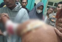 Korban Hermawan saat Ditangani Pihak Medis akibat Dibacok KM, Jumat 23 Februari 2024. Foto : Dok. Polres Tanggamus.