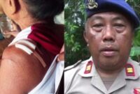 Kolase foto korban serangan buaya yang berhasil selamat dan Kasat Polairud Polres Tanggamus Iptu Zulkarnain saat memberikan keterangan di lokasi kejadian, Senin 24 Juni 2024. Foto : Edi Hidayat/Media Prioritastv.com.