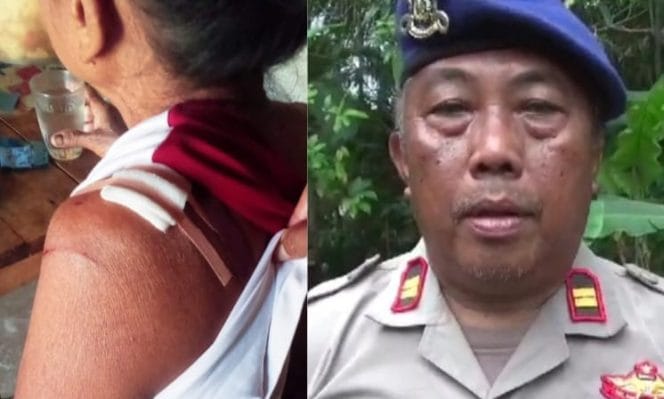 Kolase foto korban serangan buaya yang berhasil selamat dan Kasat Polairud Polres Tanggamus Iptu Zulkarnain saat memberikan keterangan di lokasi kejadian, Senin 24 Juni 2024. Foto : Edi Hidayat/Media Prioritastv.com.