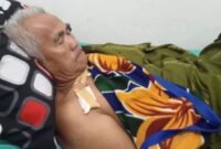 Korban gigitan buaya semaka H. Madridi saat menjalani perawatan media di RSUD Batin Mangunang, Kota Agung, Tanggamus, Rabu 17 Juli 2024.