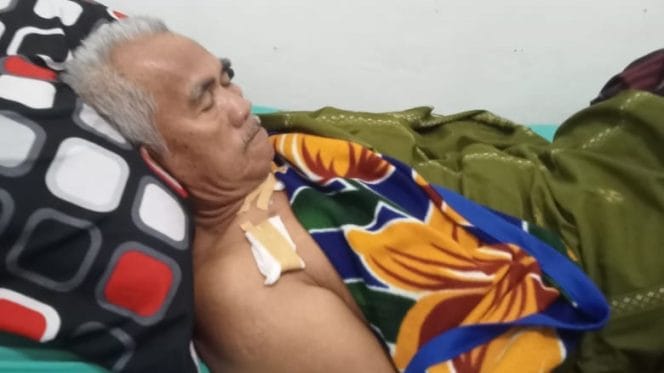 Korban gigitan buaya semaka H. Madridi saat menjalani perawatan media di RSUD Batin Mangunang, Kota Agung, Tanggamus, Rabu 17 Juli 2024.