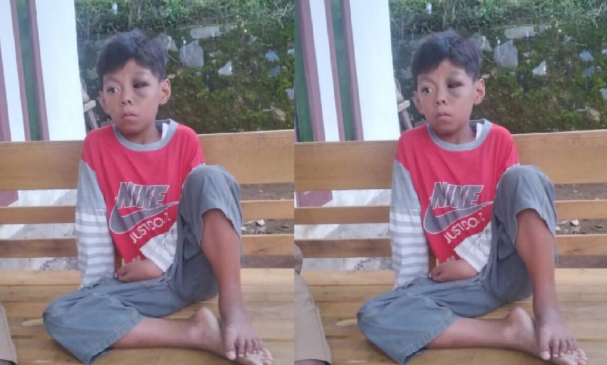 Anak yang ditemukan warga di Dusun Sukabaru, Kota Agung Timur, Tanggamus, Senin 5 Agustus 2024 | Dok. Irawansyah.