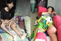 Kolase foto Dimas, Pelajar SMAN 1 Kota Agung Tanggamus yang divonis Kanker pada kaki kirinya | Dok. Keluarga Dimas.