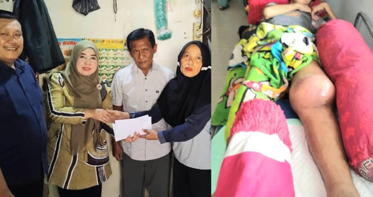 Kolase foto penyerahan Donasi oleh Kepala SMAN 1 Kota Agung, Ratna Uli kepada keluarga Dimas, Jumat 6 Desember 2024 dan kondisi Dimas sebelum mendapatkan perawatan RS | Herdi/Media Prioritastv.com.
