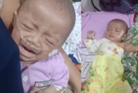 Balita Haura Al-Maira penderita jantung bocor di Wonosobo Tanggamus. 