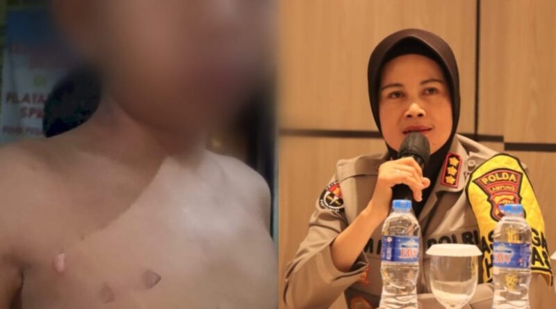 Kolase foto kondisi bocah RV yang diduga dianiaya dan Kabid Humas Polda Lampung Kombes Umi Fadilah saat memberikan keterangan, Senin 6 Januari 2025 | Dok. Istimewa.