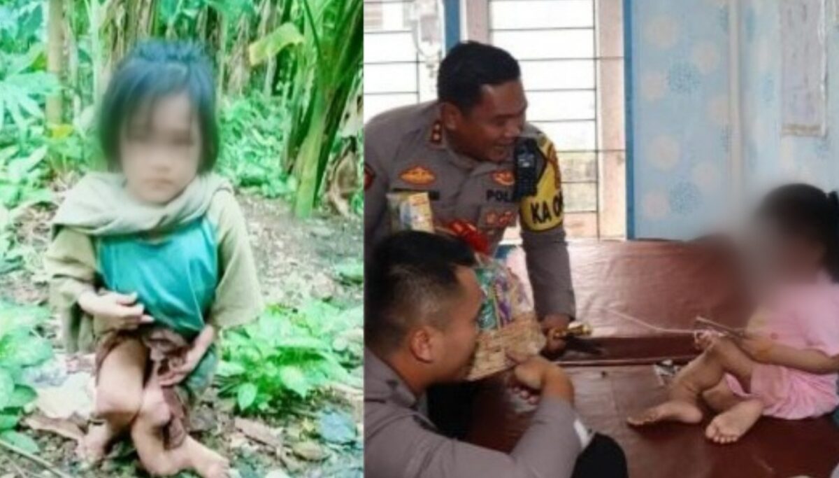 Kolase foto saat kondisi anak yang viral dan saat Kapolres Nias Selatan, AKBP Ferry Mulyana Sunarya, langsung melakukan kunjungan ke UPTD Lolowau, Senin 27 Januari 2025.