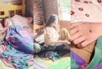 Kolase foto kondisi Eka Maryani paska mengalami KDRT oleh suaminya saat berada dikediaman orang tuanya, Kamis 21 Februari 2025 | Dok. Istimewa.