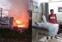 Kolase foto saat peristiwa kebakaran di Dusun Podomoro, Negeri Agung, Talang Padang dan saat korban dibawa ke klinik Husada sebelum dievakuasi ke RS Pringsewu, Sabtu 1 Maret 2025 | Asrul Ariski/Media Prioritastv.com.