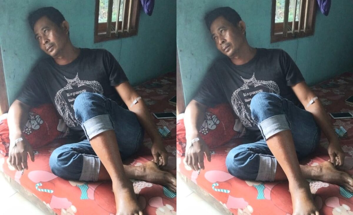 Supri Maholik paska gigitan ular berbisa ketiga dikunjungi di kediamannya, Senin 7 April 2025 | Herdi/Media Prioritastv.com.