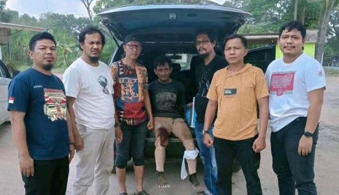 Tersanga M alias H alias Y dengan kondisi luka tembak di bagian kaki usai usai ditangkap polisi, Rabu 23 Juli 2025 | Ist.