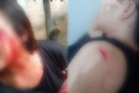 Kolase foto kondisi korban saat mengalami pendarahan akibat senjata tajam dan saat penanganan pihak medis | Dok. Keluarga Devi.