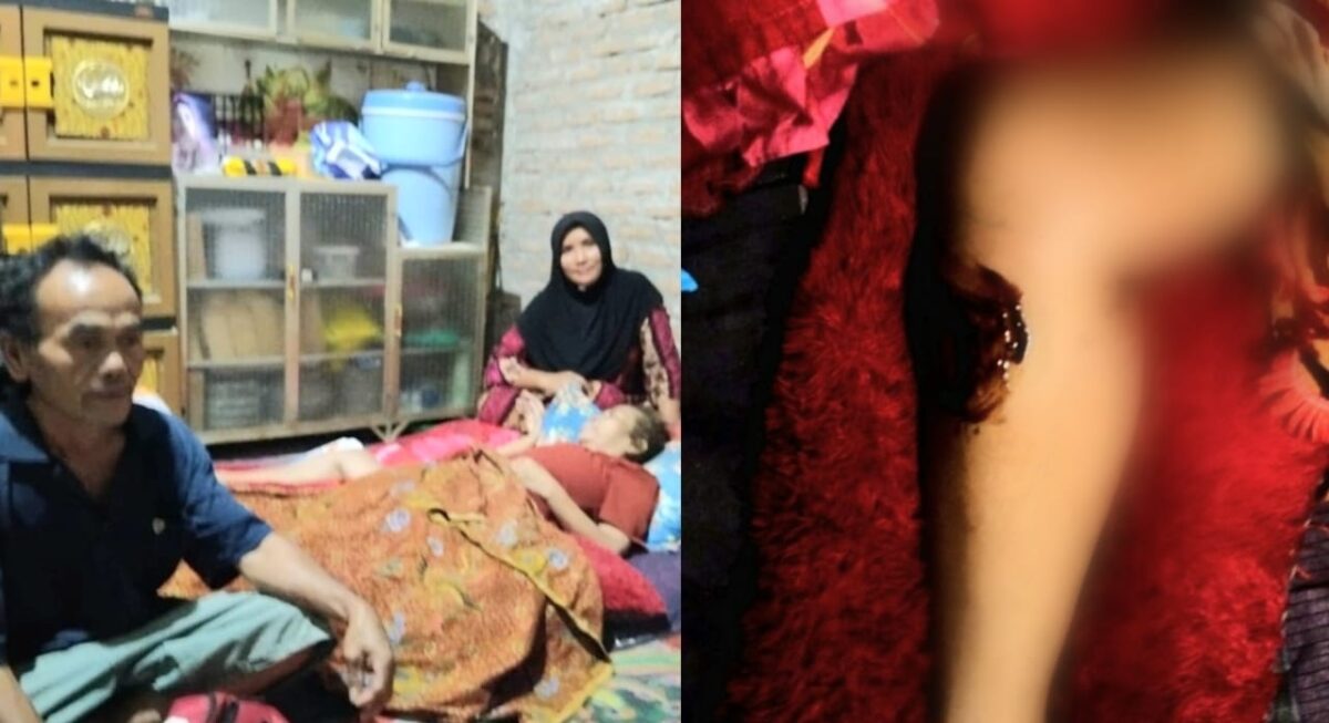 Kolase foto saat Surtini terbaring lemah di kediamannya di Wonosobo dan kondisi kaki yang mengalami kanker, Kamis 10 Juli 2025 | Herdi/Media Prioritastv.com.
