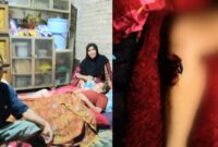 Kolase foto saat Surtini terbaring lemah di kediamannya di Wonosobo dan kondisi kaki yang mengalami kanker, Kamis 10 Juli 2025 | Herdi/Media Prioritastv.com.