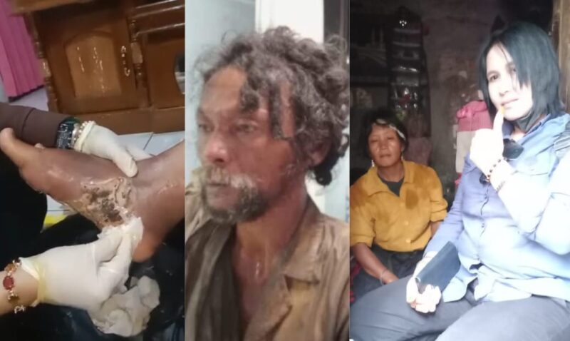 Kolase foto saat Tati Kusti Kurniasih membersihkan kaki pasien, satu pasien tati dan saat mengjungi ODGJ di salah satu sudut Kabupaten Kuningan, Jawa Barat | Dok. Ist.
