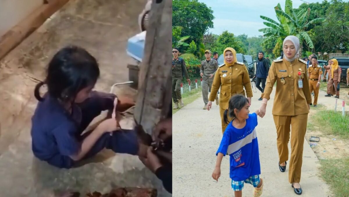 Kolase foto saat bocah 6 tahun inisial S dibuka rantainya oleh warga dan saat Wabup Lampung Jihan Nurlela mengunjunginya | Erwin/Media Prioritastv.com.