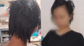 Kolase foto kondisi remaja inisial F, korban perudungan di salah satu Ponpes wilayah Talang Padang | ist/Media Prioritastv.com.