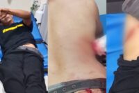 Kolase foto ketiga korban luka usai penyerahan musola Al-Mubarokah saat mendapatkan perawatan medis, Sabtu 21 Maret 2026 dinihari | ist/Media Prioritastv.com.