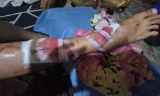 Gadis Tanggamus Diserang Buaya Saat Mencuci, Sang Ibu Berjuang Menyelamatkan Putrinya